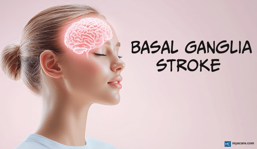 BASAL GANGLIA STROKE: TYPES, SIGNS, TREATMENT, AND RECOVERY