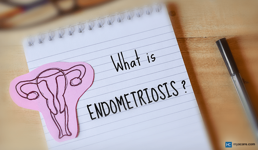 WHAT IS ENDOMETRIOSIS? 