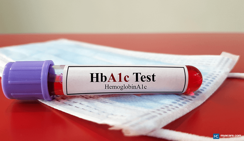 HBA1C TEST: WHAT FACTORS AFFECT ITS RESULTS?