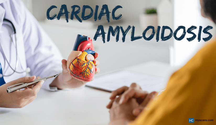 WHAT YOU NEED TO KNOW ABOUT STIFF HEART SYNDROME (CARDIAC AMYLOIDOSIS)