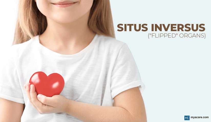 UNDERSTANDING SITUS INVERSUS: BORN WITH "FLIPPED" ORGANS 