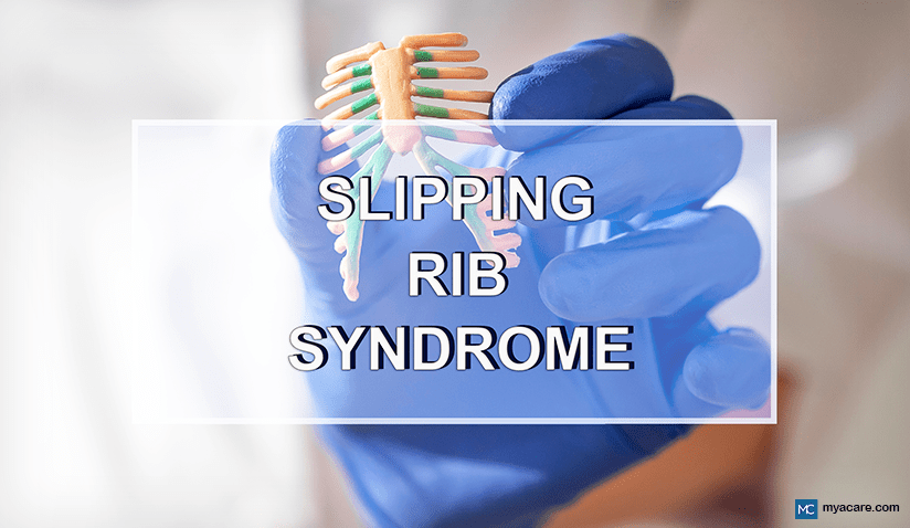 SLIPPING RIB SYNDROME: SYMPTOMS, DIAGNOSIS, TREATMENT AND MORE 