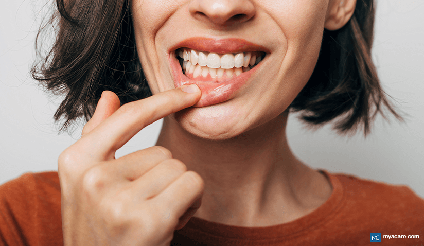 GUM DISEASES: A SILENT EPIDEMIC