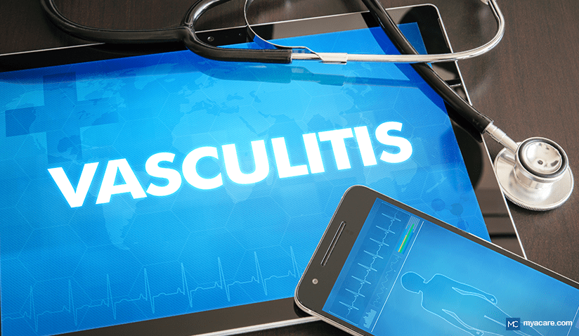 WHAT IS VASCULITIS?