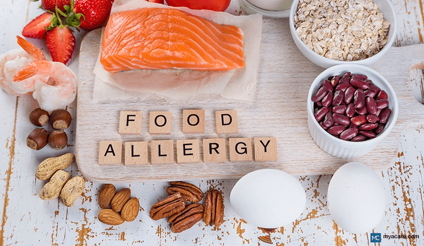 FOOD ALLERGY - 6 SIGNS YOU SHOULD GO TO THE ER