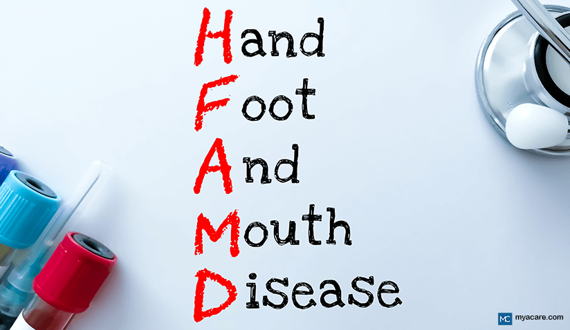 HAND, FOOT AND MOUTH DISEASE