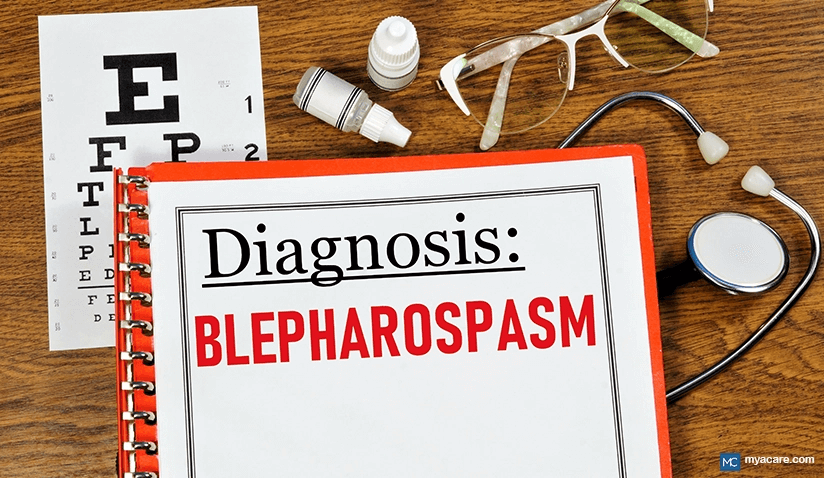 WHAT IS BLEPHAROSPASM? UNDERSTANDING EYELID TWITCHING AND SPASMS