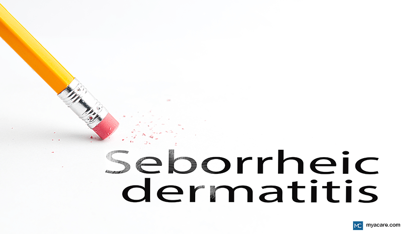 ITCHY AND SCALY: SEBORRHEIC DERMATITIS