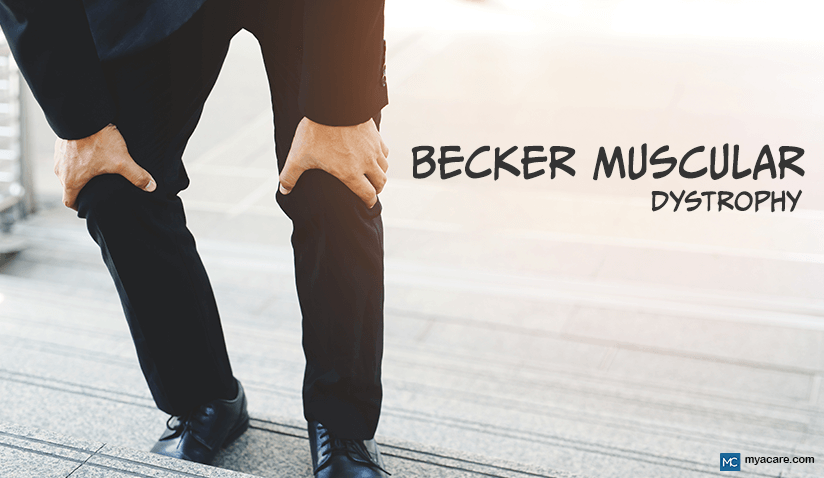 UNDERSTANDING BECKER MUSCULAR DYSTROPHY: CAUSES, SYMPTOMS, TREATMENT AND MORE