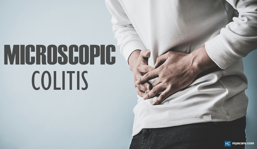 BATTLING MICROSCOPIC COLITIS: PROGNOSIS, TYPES, PREVENTION, AND TREATMENT