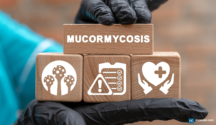 BLACK FUNGUS (RHINOCEREBRAL MUCORMYCOSIS): CAUSES, SYMPTOMS, TREATMENT AND MORE