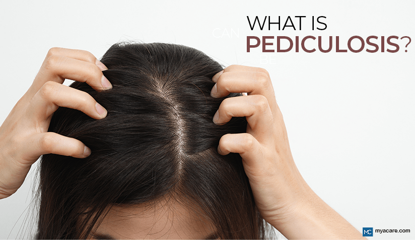 WHAT IS PEDICULOSIS?