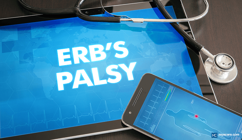 ERB’S PALSY: BRACHIAL PLEXUS NERVE INJURY IN NEWBORNS AND ADULTS