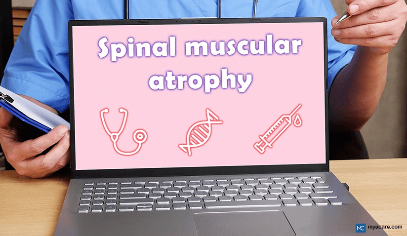 WHAT IS SPINAL MUSCULAR ATROPHY? TYPES, TREATMENTS, LATEST ADVANCES AND MORE