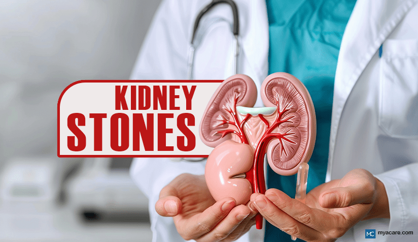 SIGNS YOU MIGHT HAVE A KIDNEY STONE