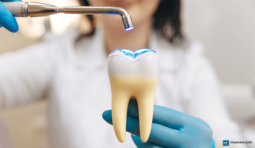 WHAT IS TOOTH FILLING AND WHAT ARE THE DIFFERENT DENTAL FILLING OPTIONS?