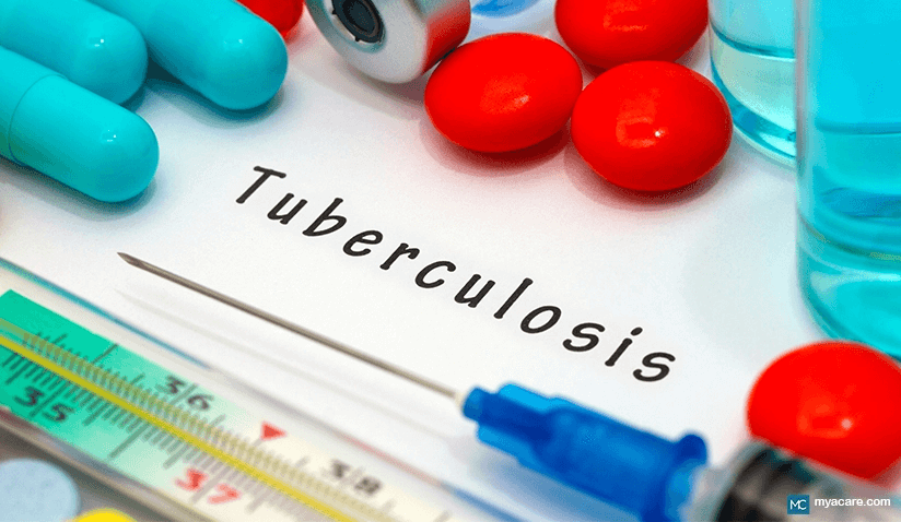 TUBERCULOSIS: PREVENTION AND TREATMENT