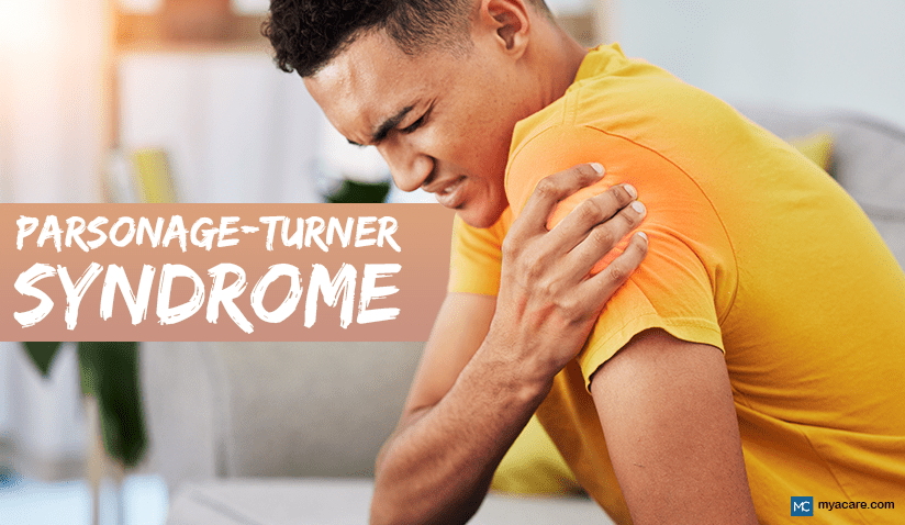 PARSONAGE-TURNER SYNDROME (BRACHIAL NEURITIS): SYMPTOMS, CAUSES, AND TREATMENT