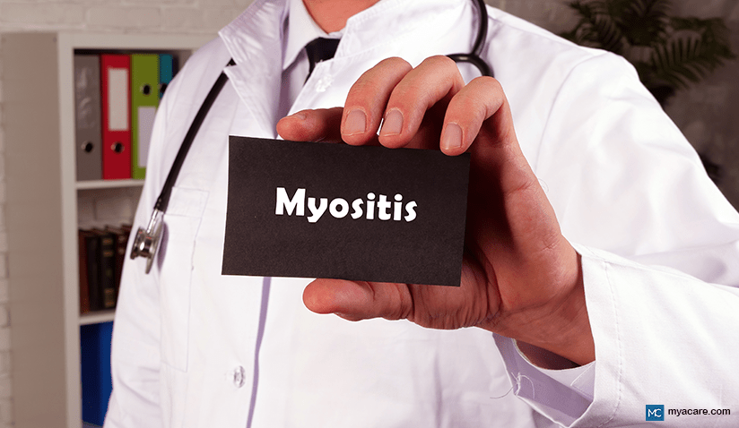 LIVING WITH MYOSITIS: HOW TO COPE WITH MUSCLE INFLAMMATION 