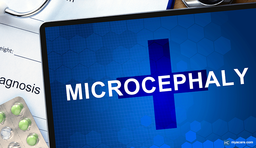 WHAT IS MICROCEPHALY? - CAUSES, IMPACT ON DEVELOPMENT AND THE IMPORTANCE OF EARLY DETECTION 