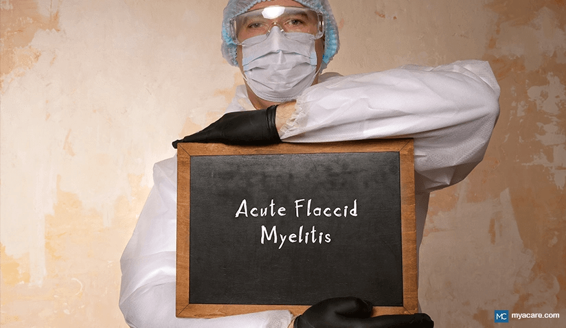 ACUTE FLACCID MYELITIS: A POLIO-LIKE ILLNESS PARENTS SHOULD KNOW ABOUT