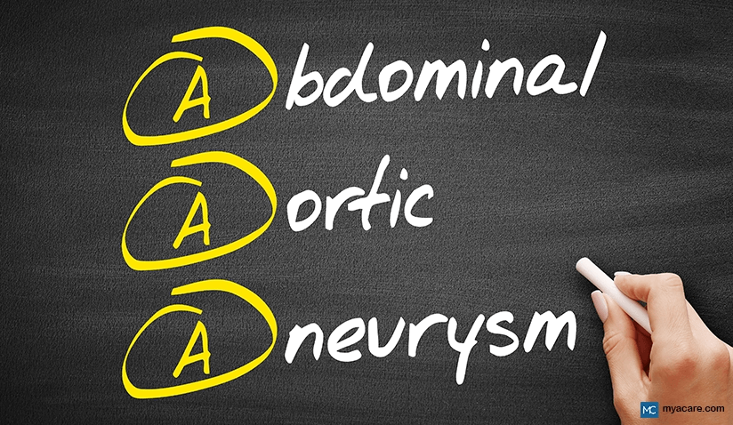 ABDOMINAL AORTIC ANEURYSM - THE IMPORTANCE AND BENEFITS OF SCREENING