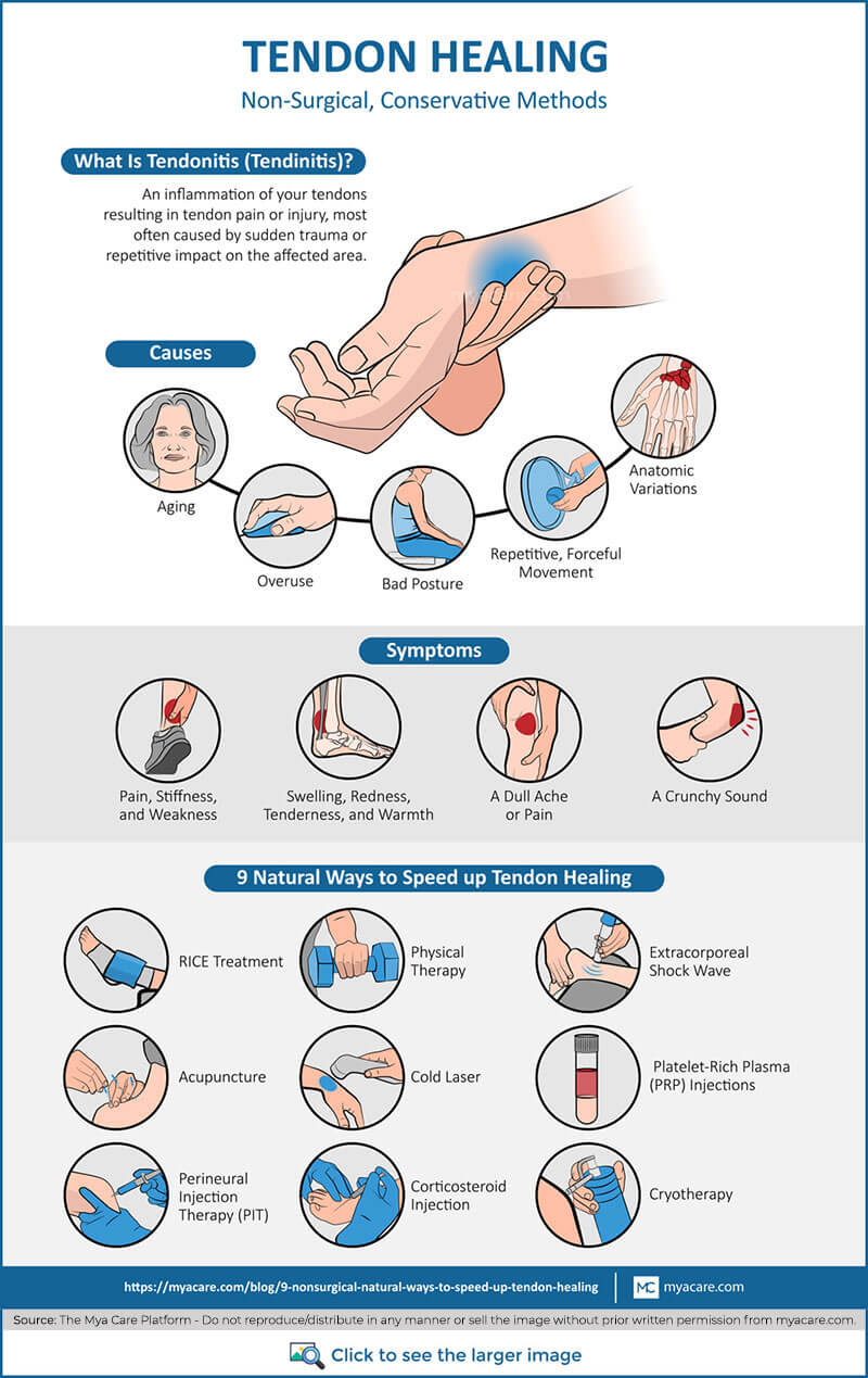 Tendonitis definition,Causes,Symptoms,non-surgical methods for tendon healing(RICE,PRP Injection,Acupuncture,Cold laser etc.)