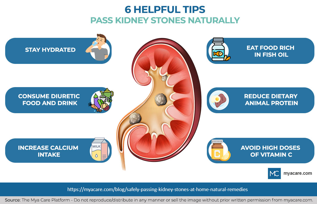 6 Tips:Hydrate,Diuretic food/drink,more Calcium,avoid high doses of vitamin C,less dietary animal protein,fish oil rich food