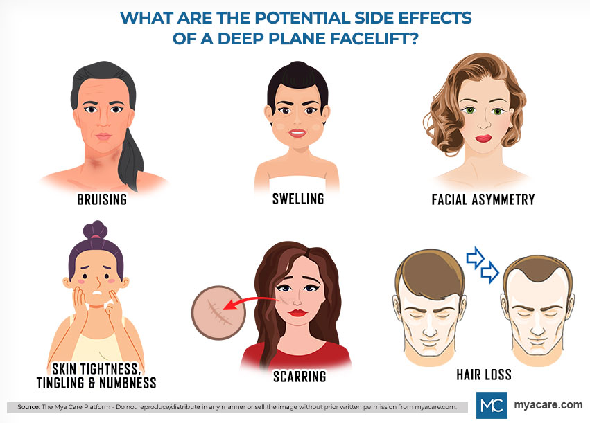 Potential Risks Deep Plane Facelift:Bruising,Swelling,Facial Asymmetry,Hair Loss,Scarring,Skin Tightness,Tingling & Numbness