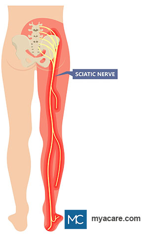 Sciatic nerve origin and course in the human body