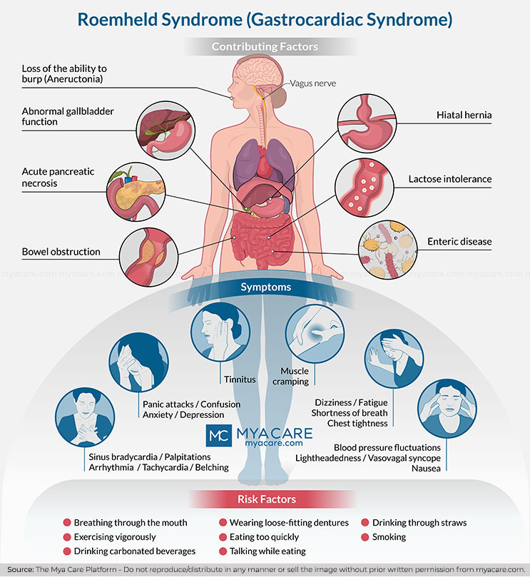 Roemheld Syndrome/ Gastrocardiac Syndrome - Factors that stimulate the Vagus nerve, causing Symptoms in people at risk