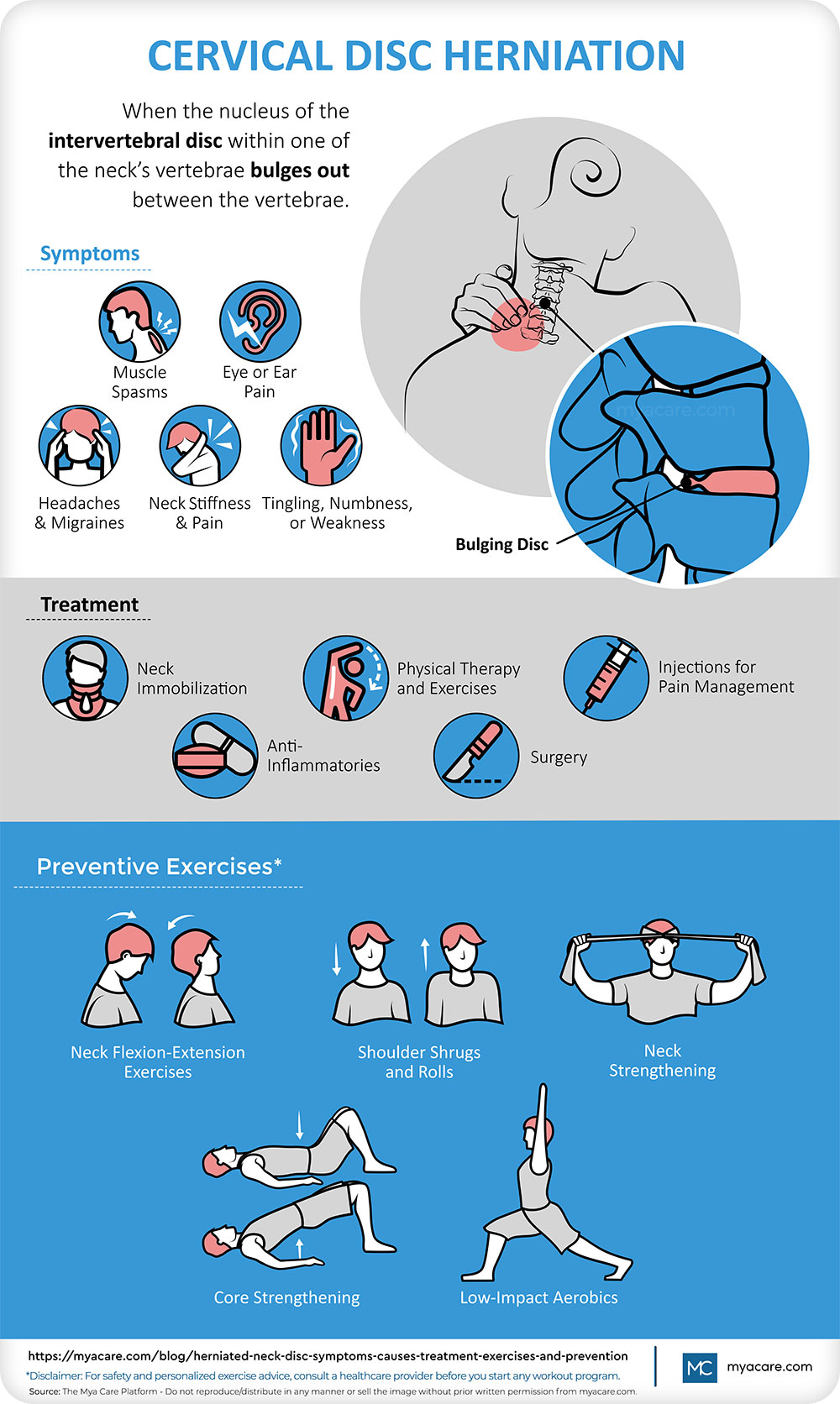 Cervical Disc Herniation - Affected area with bulging disc, Definition, Symptoms, Treatment, Preventive Exercises