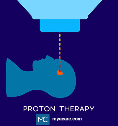 Proton therapy - High energy proton beam targets tumors more precisely, avoids healthy tissue with reduced side effects