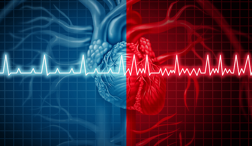 ABLATION FOR TREATING ATRIAL FIBRILLATION: A PERSONALIZED APPROACH 