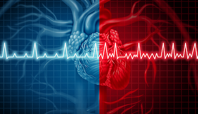 ABLATION FOR TREATING ATRIAL FIBRILLATION: A PERSONALIZED APPROACH 