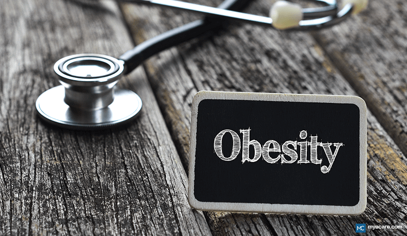 OBESITY HEALTH RISKS, POTENTIAL CAUSES AND LIFESTYLE CONSIDERATIONS